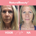 NaturalBeauty™ - Elektrotherapie set voor huid en haar | 50% KORTING